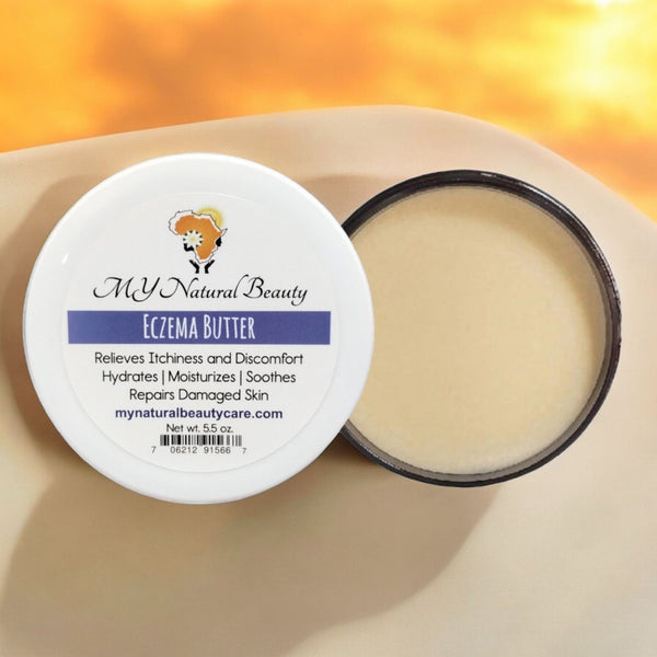 Eczema Butter | Skin and Scalp Treatment