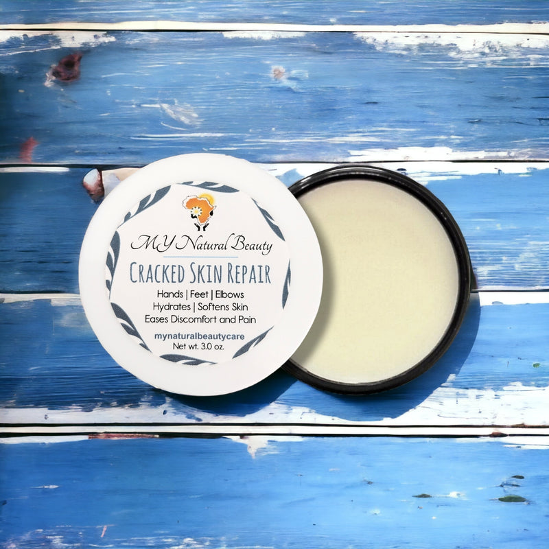 Hand and Foot Butter (Cracked Skin Repair)