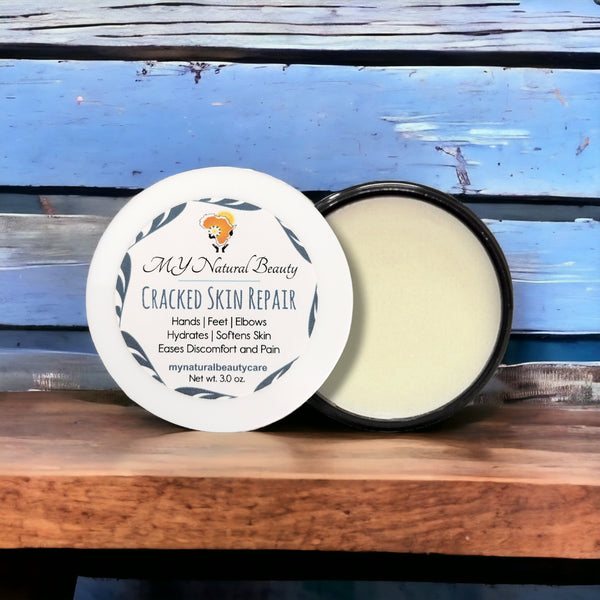 Hand and Foot Butter (Cracked Skin Repair)